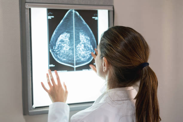 Breast Cancer Screening Market by Type (Mammography, MRI [Magnetic Resonance Imaging], Ultrasound, Tomography, Genome Test, and Biopsy), by Product (Instrument-based Product [Biopsy and Imaging] and Platform-based Product [PCR (Polymerase Chain Reaction), Next-generation Sequencing, Microarrays, and Others]), and by End User (Hospitals, Diagnostic Centers, and Cancer Institutes) – Global Outlook & Forecast 2022-2030