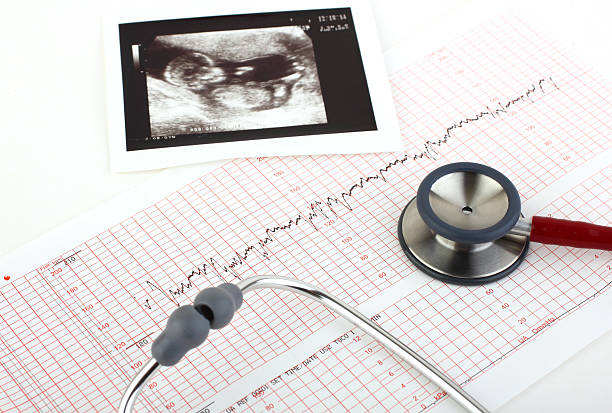 Fetal Monitoring Market by Product (Ultrasound, Fetal Electrodes, Telemetry Devices, Electronic Fetal Monitoring, Accessories & Consumables, and Others), by Portability (Portable and Non-Portable), by Method (Invasive and Non-Invasive), by Application (Intrapartum Fetal Monitoring and Antepartum Fetal Monitoring), by End User (Hospitals, Obstetrics & Gynaecology Clinics, and Home Settings) - Global Outlook & Forecast 2022-2030