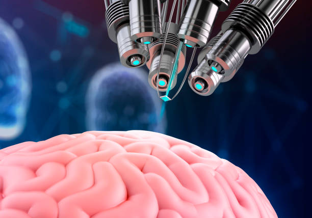 Medical Bionic Implants Market by Product (Vision Bionics/Bionic Eye, Brain Bionics, Heart Bionics/Artificial Heart, Orthopedic Bionics and Ear Bionics), by Method of Fixation (Implantable Bionics and External Bionics), by End Users (Research Laboratories, Hospitals & Clinics, and Others) – Global Outlook & Forecast Period 2022-2030