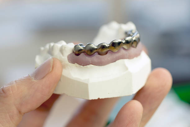Dental Crowns and Bridges Market by Type (Bridges and Crowns), by Material (Metal, Titanium, Porcelain fused with metal, Zirconium, and Ceramic), by End User (Dental Hospitals & Clinics, and Dental Laboratories), - Global Outlook & Forecast 2022-2030