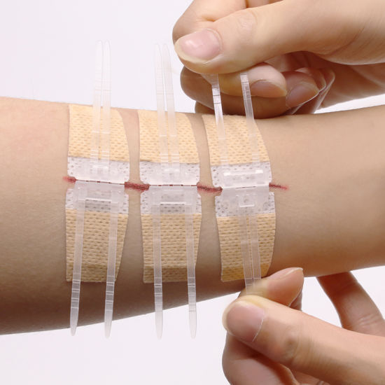 Wound Closure Market by Product (Sutures, Hemostatic Agents, Staplers, Others), by Application (Cardiology, Orthopedics, Gynecology, General Surgery, Ophthalmic, Others), by End User (Hospitals, Ambulatory Surgical Centers, Specialty Clinics, Others) – Global Outlook & Forecast 2022-2030