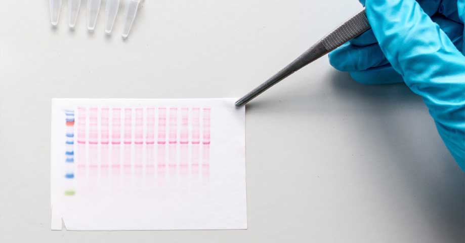 Western Blotting Market by Product (Consumables, and Instruments), by Application (Biomedical and Biochemical Research, Disease Diagnosis, and Agriculture), by End User (Academic & Research Institutes, Biopharma & Biotechnology, and Hospitals & Diagnostic Laboratories) – Global Outlook & Forecast 2022-2030