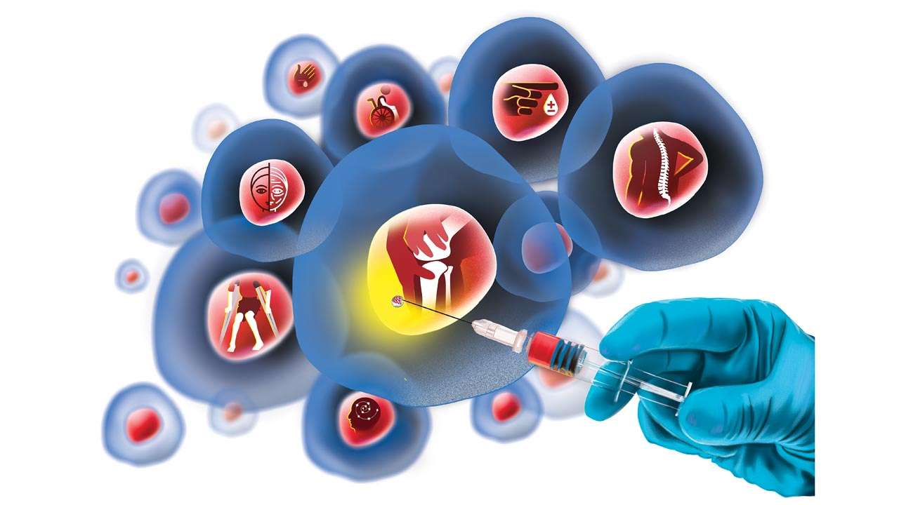 Cell Therapy Market by Use Type (Clinical Use and Research Use), by Therapy Type (Autologous, and Allogenic), by Therapeutic Area (Malignancies, Musculoskeletal Disorder, Autoimmune Disorder, Dermatology and Other), by End User (Hospital & Clinic and Academic and Research Institute) – Global Outlook & Forecast 2022-2030