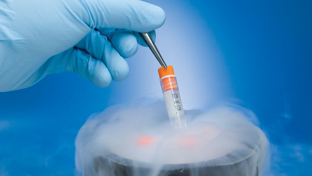 Frozen Tissue Samples Market by Product Type (Frozen Normal Tissue Samples, Frozen Tumor Tissue Samples, Fresh Frozen Tissue Samples, Formalin-Fixed Paraffin-Embedded Tissues Samples, and Frozen Diseased Tissue Samples), by Application (Cancer Research, Disease Diagnosis, and Morphological Analysis), and by End User (Hospital & Clinics, Diagnostic Centers, Forensic Laboratories, Academic & Research Centers, Pharmaceutical & Biotechnology Companies) â€“ Global Outlook & Forecast 2022-2030