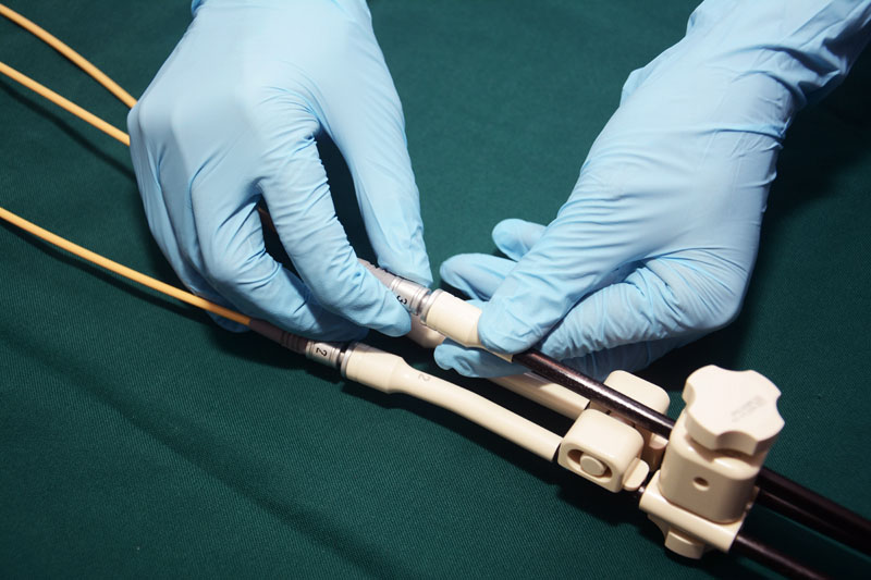 Brachytherapy Market by Product (Seeds, Brachytherapy After Loaders, Brachytherapy Applicators [Intraluminal Applicators, Interstitial Applicators, Intraoperative and Surface Applicators], and Electronic Brachytherapy), Dosage Type/Techniques (High Dosage Rate (HDR) Brachytherapy, Low Dosage Rate (LDR) Brachytherapy, Medium Dosage rate (MDR) Brachytherapy, Ultra-Low Dosage Rate Brachytherapy, Pulse Dosage Rate (PDR) Brachytherapy, and Image Guided Brachytherapy) Application (Gynecological Cancer, Prostate Cancer, Anal/Rectal Cancer, Breast Cancer, and Esophageal Cancer), and End User (Hospitals, Oncology Treatment Centers, Specialty Clinics, Clinical Laboratories, & Academic and Medical Centers) – Global Outlook & Forecast 2022-2030