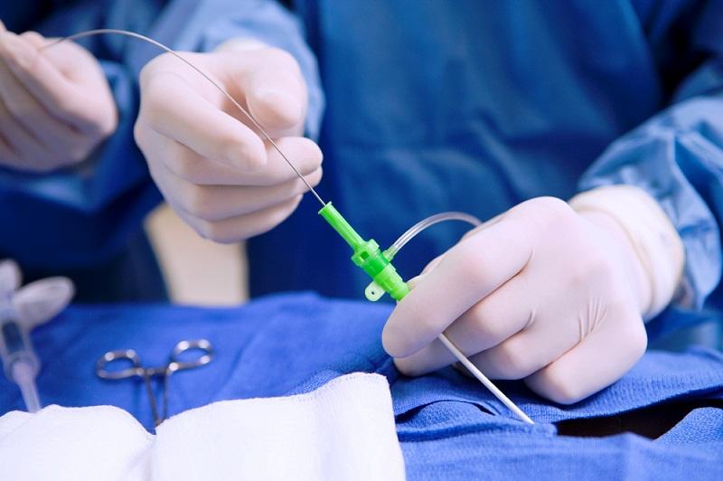 Surgical Sealants Market by Type (Biological Sealants, Synthetic and Semi-Synthetic Sealants), by Application (General surgery, Orthopedic, Cardiovascular, Central Nervous System, Ophthalmology, Urology, and Pulmonary), and by End User (Hospitals, Ambulatory Surgical Centers, and Others) – Global Outlook & Forecast 2022-2030