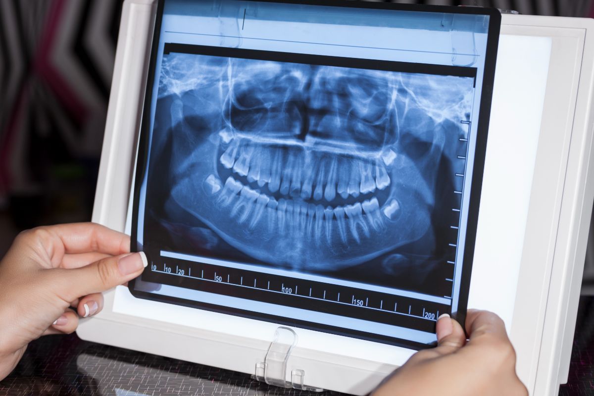 Dental Imaging Market by Product (Intraoral and Extraoral), by Application (Oral and Maxillofacial Surgery, Implantology, and Teeth Alignment), and by End User (Dental Clinics and Hospitals) - Global Outlook & Forecast 2022-2030