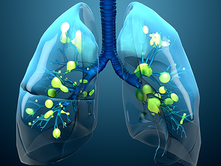 Acute Respiratory Distress Syndrome Therapeutics Market by Drug Class (Bronchodilators, Corticosteroids, Antimicrobial Agents, and Other Drug Class) and by Distribution Channel (Hospital Pharmacies, Retail Pharmacies, and Online Pharmacies) - Global Outlook & Forecast 2022-2030