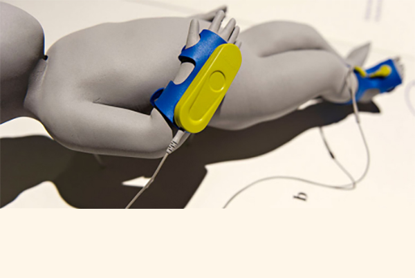 Dehydration Monitoring Systems Market by Product (Mobile Devices, Wearable Devices), by Application (Disease Diagnosis, Drug Abuse Detection, Athletic Performance Optimization) – Global Outlook & Forecast 2022-2030