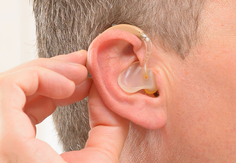 Hearing Aids Devices Market by Product (Behind-the-Ear (BTE), In the Ear (ITE)), Patient Type (Adults, Pediatrics), Distribution Channel (Retail Sales, E-Pharmacy) – Global Outlook & Forecast 2024-2032