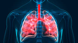 Idiopathic Pulmonary Fibrosis Market by Drug Class (Tyrosine Kinase Inhibitors, Antifibrotic Agents), Distribution Channel (Hospital Pharmacies, Retail Pharmacies) – Global Outlook & Forecast 2022-2030