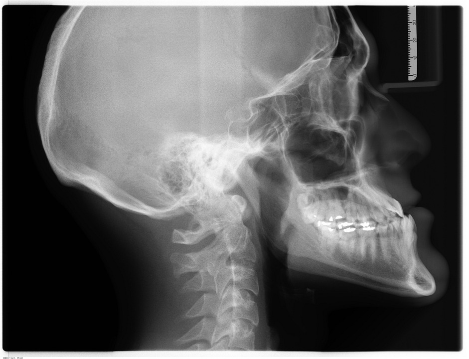 Digital Radiography Market by Product (Computed Radiography, Direct Digital Radiography), by Type (Dynamic, Static), by Application (General, Dentistry, Oncology, Orthopedic) – Global Outlook & Forecast 2022-2030