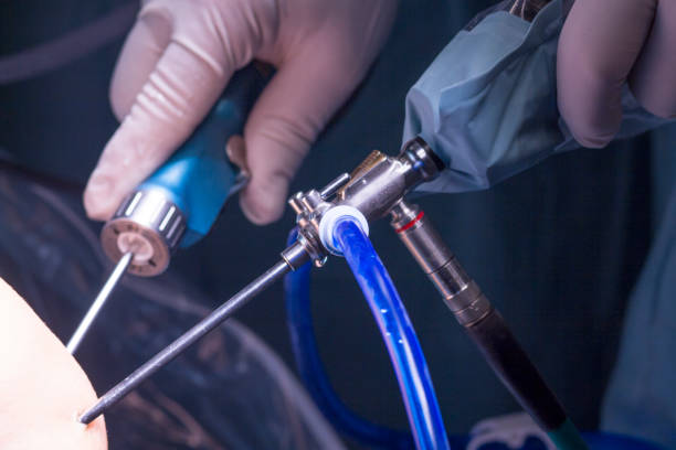 Arthroscopy Devices Market by Product (Arthroscope and Arthroscopy Implants), Application (Knee Arthroscopy and Hips Arthroscopy), End-user (Hospitals and Ambulatory Surgical Centers) – Global Outlook & Forecast 2022-2030