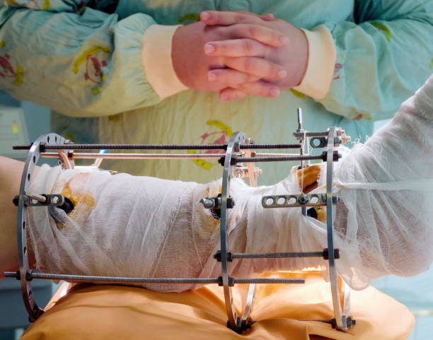 Global Orthopedic Trauma Fixation Devices Market by Product (Internal and External fixators), Site (Lower and Upper Extremities), Material (Titanium and Stainless Steel), End-user (Hospitals and Orthopedic Centers) – Global Outlook & Forecast 2022-2030