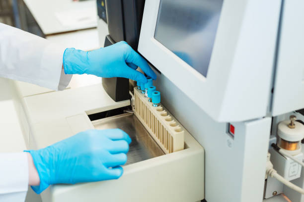 Coagulation Analyzers Market by Product (Analyzers and Consumables), by Technology (Mechanical, Optical), by Test type (Prothrombin Time Testing (PT), D-dimer Testing), by End User (Hospitals, Clinical Labs) – Global Outlook and Forecast 2022-2030