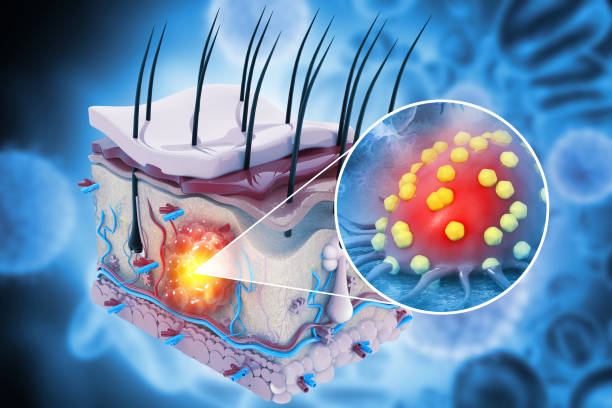 Basal Cell and Squamous Cell Carcinoma Therapeutics Market by Drug Class (Antineoplastics Monoclonal Antibodies), Route of Administration (Topical, Parenteral), Distribution Channel (Hospital Pharmacies, Retail Pharmacies) - Global Outlook & Forecast 2022-2030