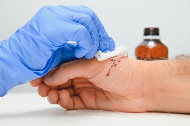 Topical Wound Agents Market by Product (Gels, Creams), Application (Chronic Wounds, Acute Wounds), End-user (Hospitals, Clinics) – Global Outlook & Forecast 2022-2030