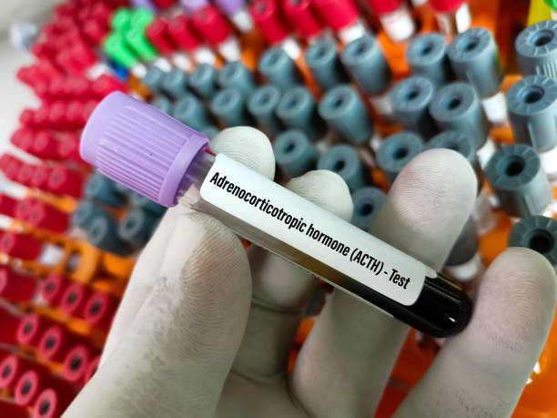 Adrenocorticotropic Hormone Market by Source (Natural, Synthetic), Application (Neurology, Rheumatology), End-user (Hospitals and Clinics, Home Care) – Global Outlook & Forecast 2023-2031