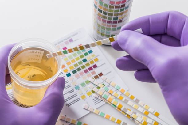 Creatinine Testing Market by Product Type (Consumables, Instruments), Application (Urinary Tract Obstruction, Renal Failure), End User (Hospital & Clinics, Diagnostic Centres, Research Institutes) – Global Outlook & Forecast 2023-2031