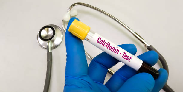 Calcitonin Treatment Market by Indications (Paget’s Disease of Bone, Postmenopausal Osteoporosis, and Hypercalcemia), by Route of Administration (Parenteral, Inhalation) - Global Outlook and Forecast 2023-2031