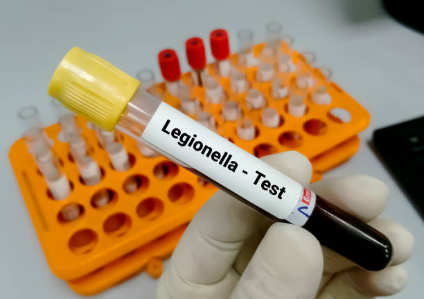 Legionella Testing Market by Type (Direct Fluorescent Antibody (DFA) Testing, Culture Media, Serology, Polymerase Chain Reaction (PCR), Urine Antigen Testing) and End User (Hospitals, Diagnostic Laboratories, Others) – Global Outlook & Forecast 2023-2031