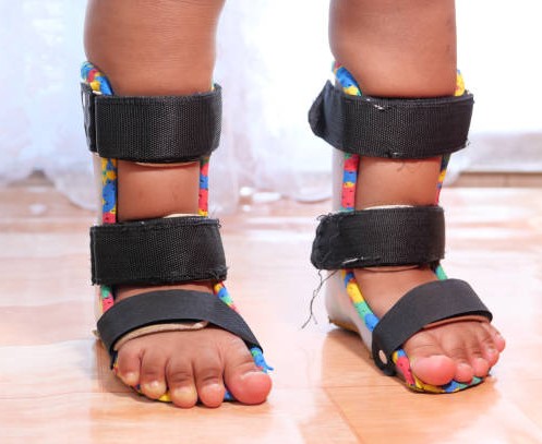 Orthotic Devices Market by Type (Static Orthotic Devices, Dynamic Orthotic Devices), Product (Upper Limb Orthotic Devices, Lower Limb Orthotic Devices), End-user (Hospitals & Clinics, Ambulatory Surgical Centers) - Global Outlook and Forecast 2023-2031