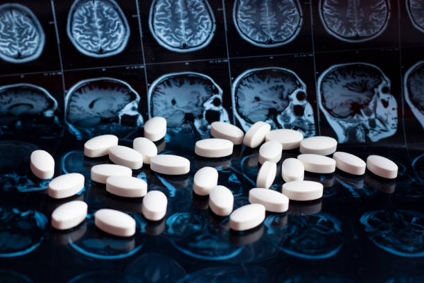 Neurological Disorder Drugs Market by Indication (Epilepsy, Alzheimerâ€™s Disease, Parkinsonâ€™s Disease), Drug Class (Cholinesterase Inhibitors, NMDA Receptor Antagonists,) End User (Hospitals, Specialty Clinics) â€“ Global Outlook & Forecast 2023-2031