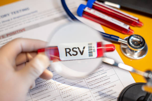 Respiratory Syncytial Virus (RSV) Therapeutics Market by Drug Type (Palivizumab, Ribavirin), Distribution Channel (Hospital Pharmacies, Retail Pharmacies)-Global Outlook & Forecast 2023-2031