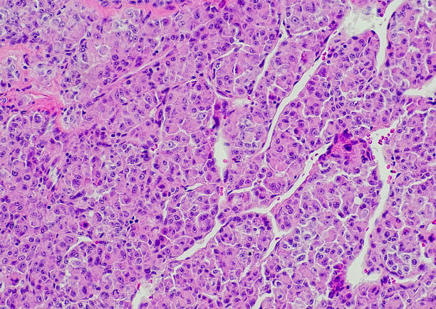 Alveolar Soft Part Sarcoma Market by Type (Monotherapy, Combination Therapy), Therapy (Chemotherapy, Targeted Therapy), End User (Hospitals, Cancer Speciality Centers) - Global Outlook and Forecast 2023-2031