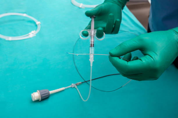 Cardiac Diagnostic Catheters Market by Type (Electrophysiology Catheters, PTCA Balloons Catheters), End User (Hospitals, Diagnostics and Imaging Centers) - Global Outlook and Forecast 2023-2031