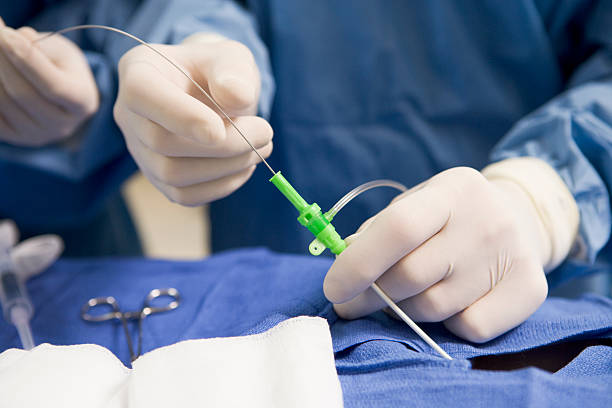 Atrial Fibrillation Surgery Devices Market by Procedure (Catheter Ablation, Surgical Ablation), End User (Hospitals & Surgical Centers, Ambulatory Care Centers) - Global Outlook and Forecast 2023-2031