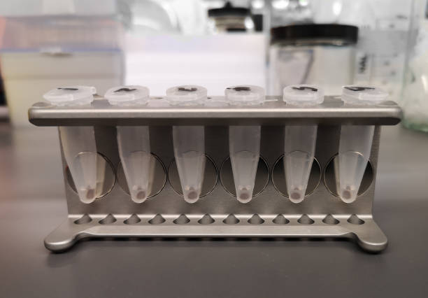 Magnetic Beads Market by Type (Cells & microbe, Nucleic Acid, Proteins, Others), Application (Bioresearch, In-vitro Diagnostics, Others) – Global Outlook & Forecast 2023-2031