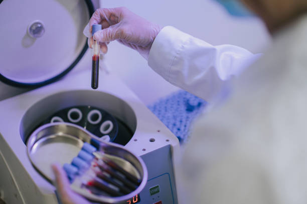 Platelet Rich Plasma Market by Type (Pure, Leucocyte Rich, Others), Application (Orthopedics, Sports Medicine, Cosmetic Surgery, Dermatology, Ophthalmic Surgery, Neurosurgery, General Surgery, Others) – Global Outlook & Forecast 2023-2031