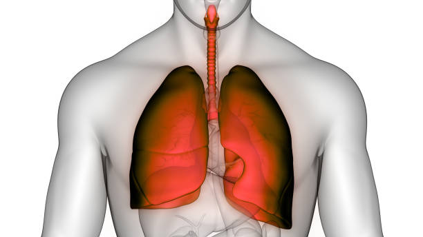 Pleural Effusions Treatment Market by Disease Type (Transudative, Exudative), Treatment (Quantitative Test Chest Draining, Pleurodesis), End User (Hospitals, Ambulatory Clinics, Other End Users) – Global Outlook & Forecast 2023-2031