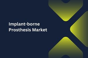 Implant-borne Prosthesis Market by Product Type (Tissue Level Prosthetics, Bone level prosthetics), Modality (Screw-retained, Cement-retained), and Material (Zirconium, Titanium) – Global Outlook & Forecast 2023-2031